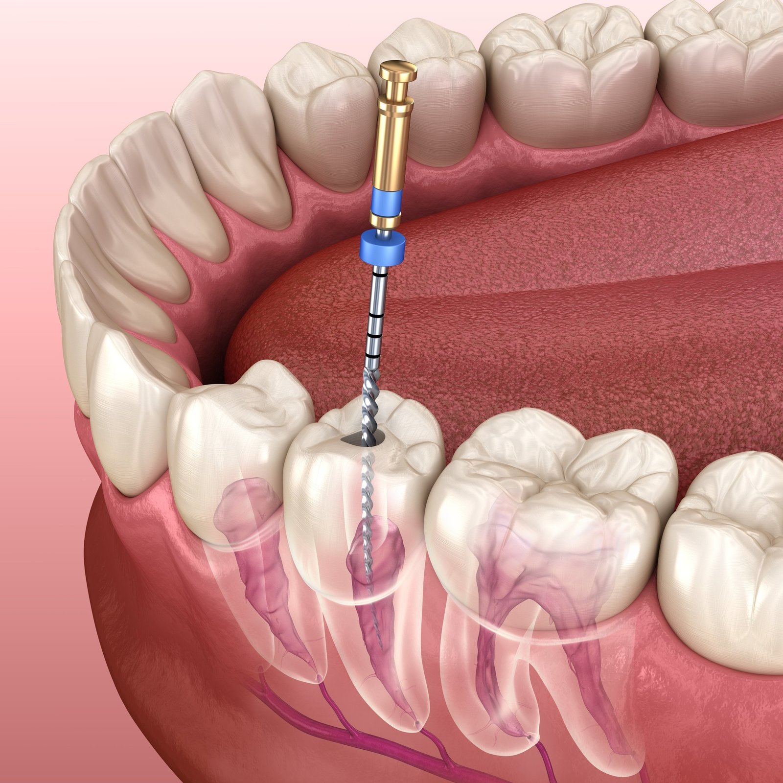 Best RCT Specialist in Faridabad