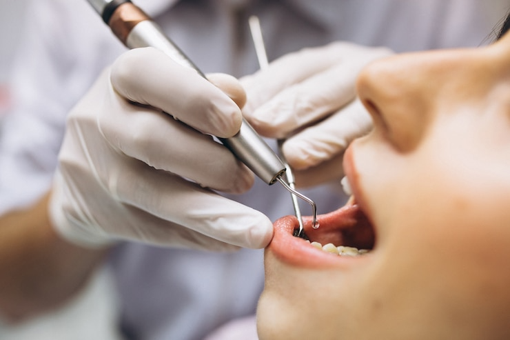 Best Gum Treatment Doctors in Faridabad