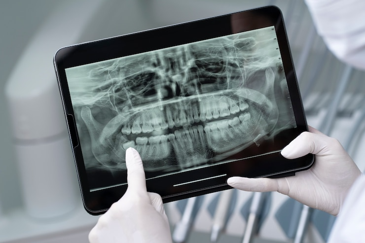 Best Dental Digital X-ray Centre in Faridabad